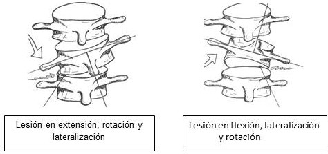 lesi&oacuten Vértebras 